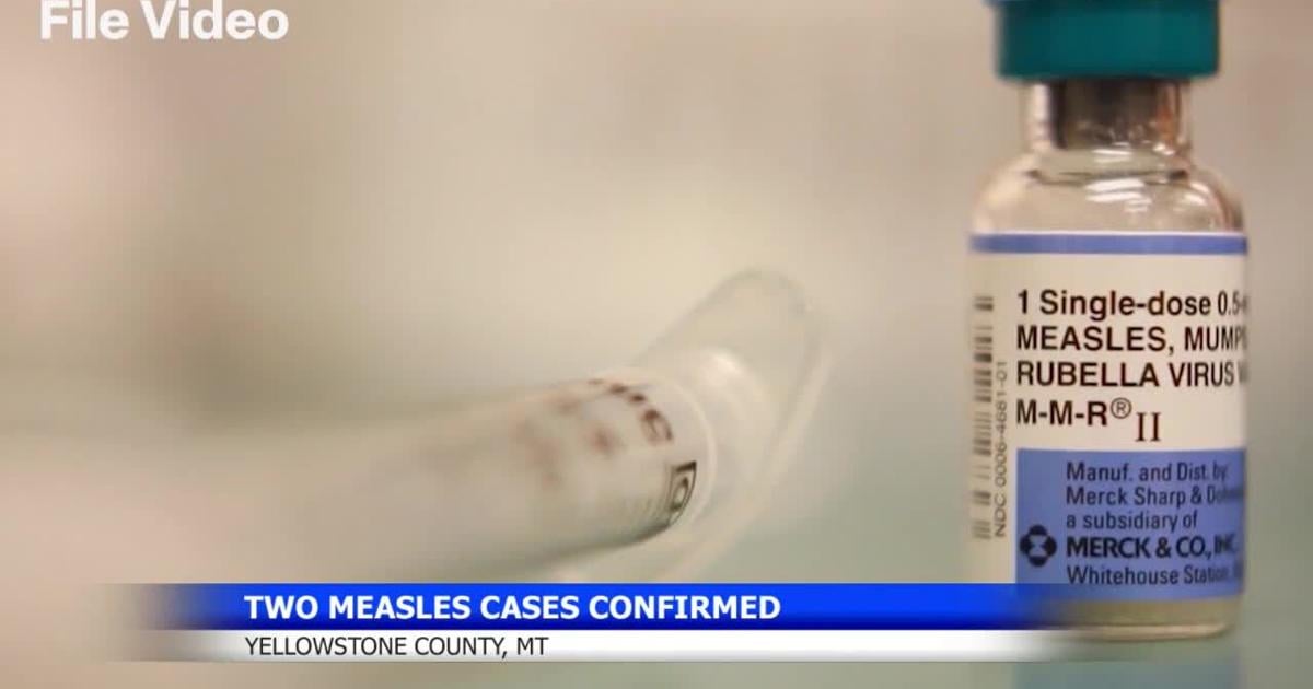 Two measles cases confirmed in Yellowstone County, vaccination urged by health officials
