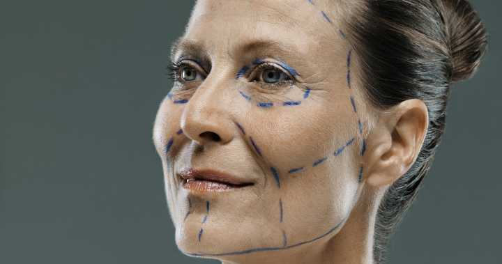 A Guide to Deep-Plane Facelifts