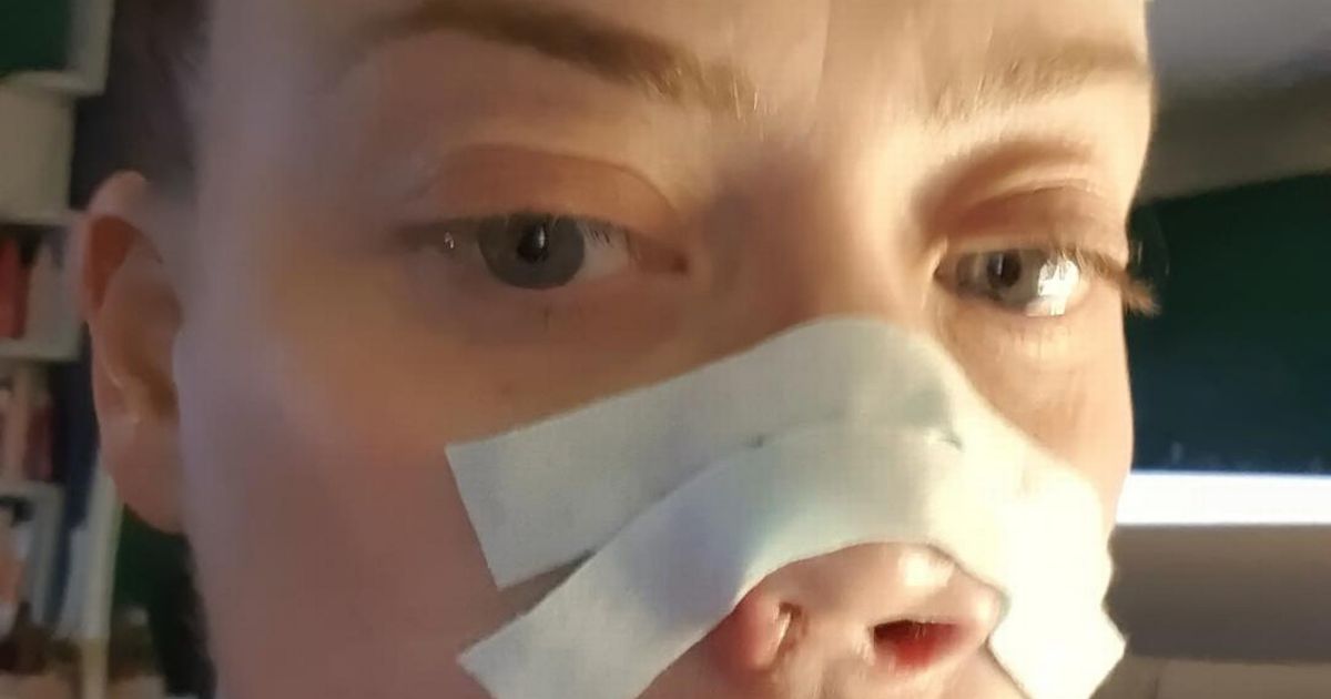 Mum's face collapses after Turkey teeth treatment in 'worst pain of life'