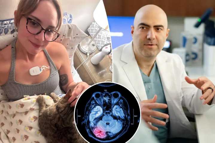 Doctor on what’s causing spike of stroke cases in young people