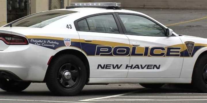 Driver critical following shooting in New Haven