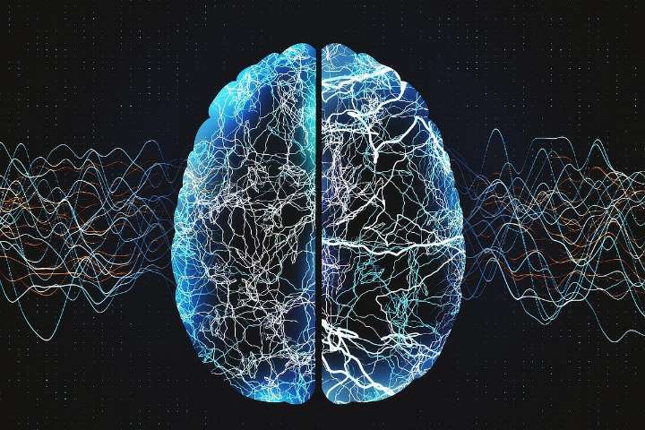 Epilepsy More Common With Frontotemporal Dementia