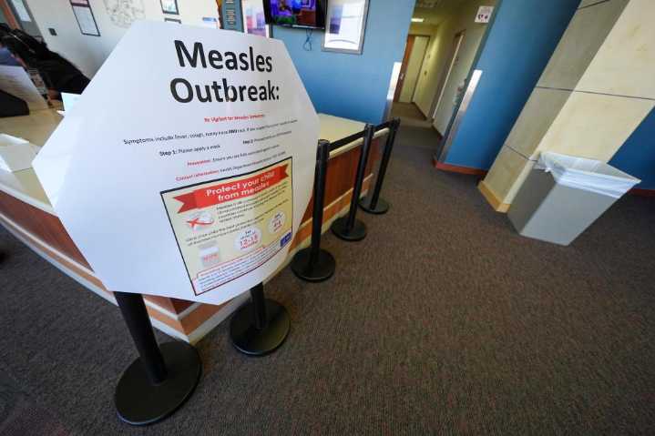 Where are Colorado's measles exposure risks?