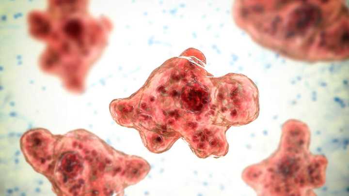 Brain-Eating Amoeba Kills Woman Who Used Tap Water In Nasal Rinse Device