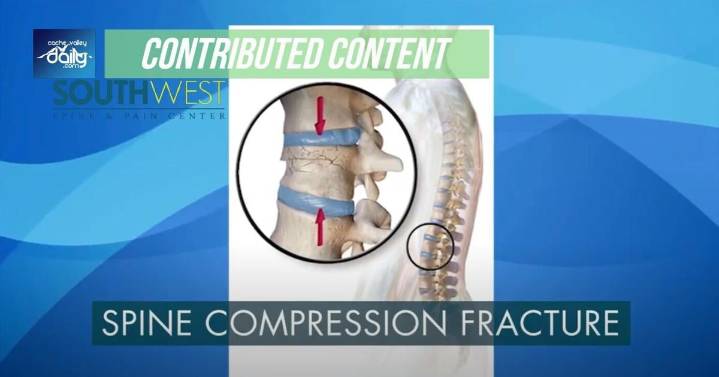 Logan doctors offer relief for one of the most painful spine injuries