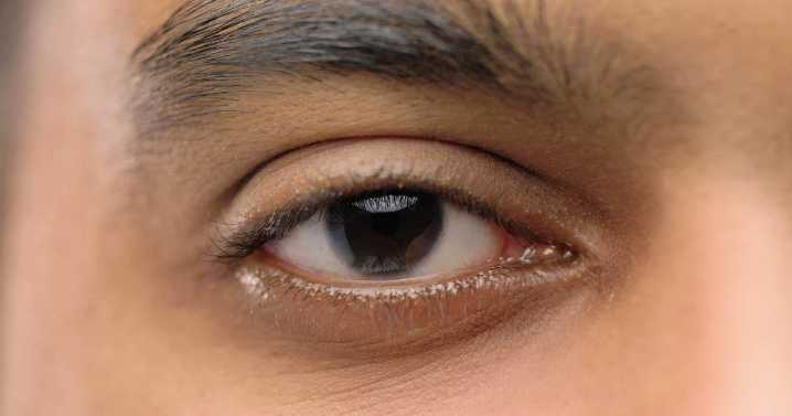 Tono-Vera handheld tonometer has ‘close to zero’ deviation from Ocular Response Analyzer