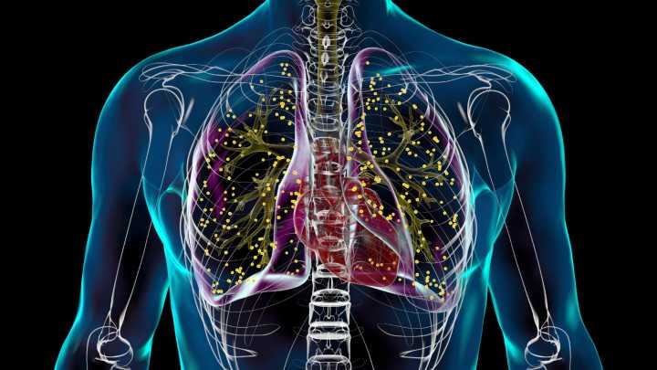 Cases of ‘world’s most deadly infection’ surge 10% in ‘disturbing wake