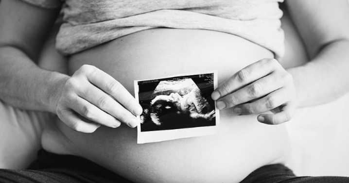 Jennifer Oliver O'Connell: Let’s stop fighting about abortion and agree on life