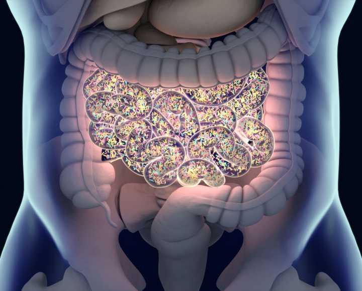 Cancer and the Microbiome: A Gut Check