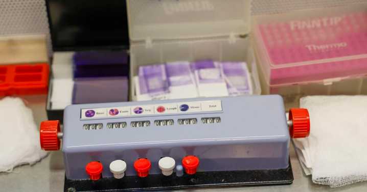 A common parasite can decapitate human sperm − with implications for male fertility