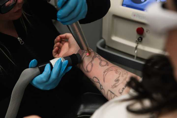 Tattoos are supposed to be permanent and personal. But what happens when you outgrow them?