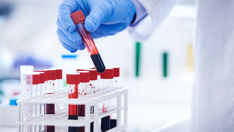 Blood Culture Time Tied to Severity in Blood