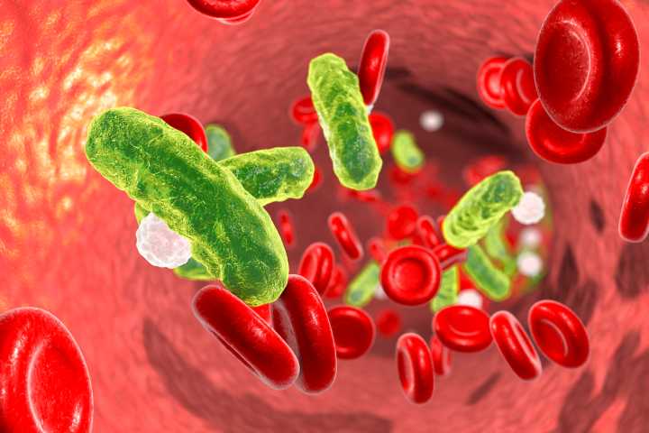 Statins Lower Mortality by 39% in Sepsis Patients