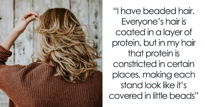 20 Netizens With Various ‘Medically Cool’ Body Traits Share Things They Are Happy (Or Not) To Have