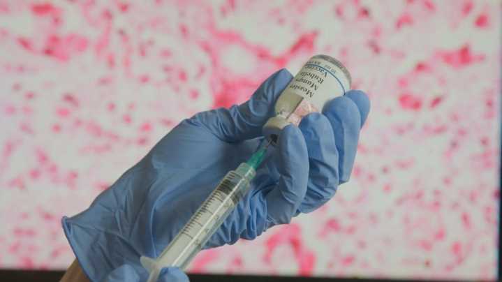 Measles case confirmed in Allegan County