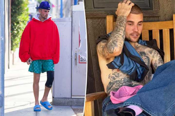 Justin Bieber reveals mystery injury as he continues sparking concern with odd behavior