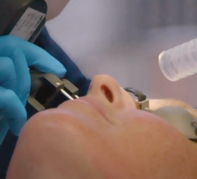 (Video) See How CO2 Laser Treatment Removes Wrinkles and Scars