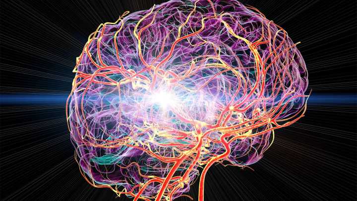 Global Stroke Deaths Still a Concern, and It's Not Just About Developing Countries