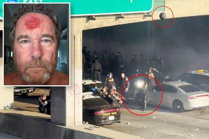 Post photographer shot with rubber bullet in LA riots