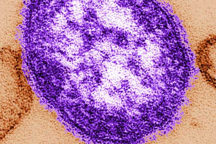 What’s behind CDC’s latest measles warning to international travelers