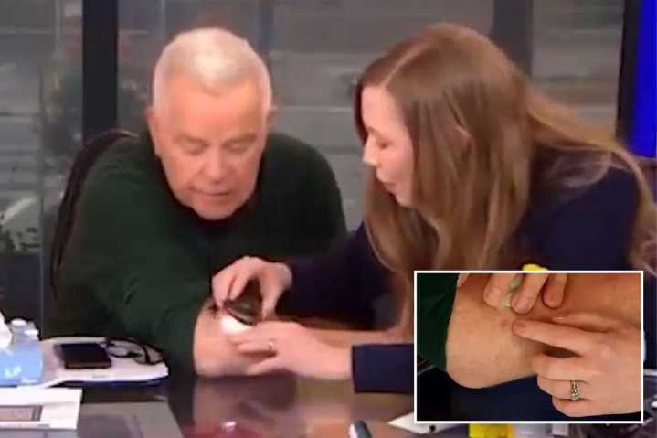 Fox Philadelphia host Mike Jerrick discovers skin cancer during on