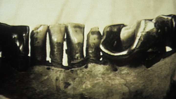 Behind History’s Icons II: Hitler’s Jaw and Cold War Secrets
