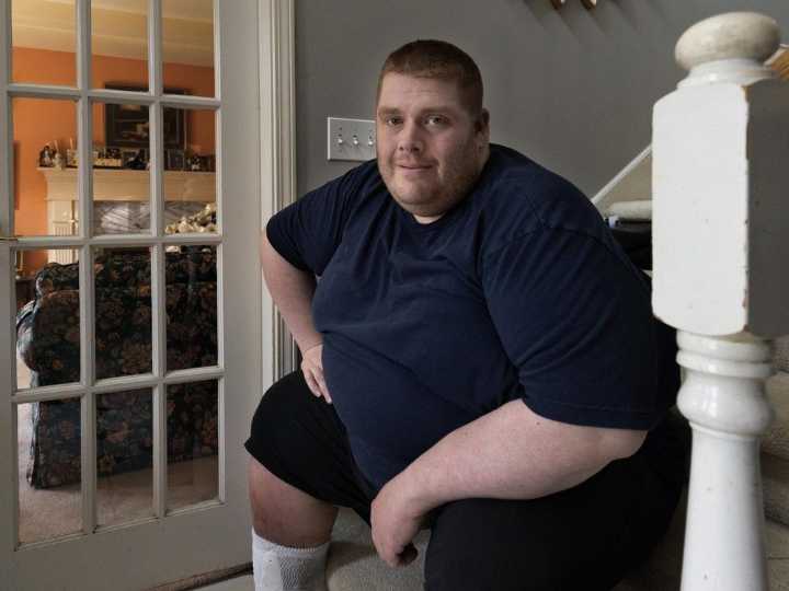 Family says Coquitlam man could have died from extreme cellulitis after neglect from CLBC