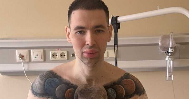 'Russian Popeye' who injected oil into biceps hospitalised after health fears