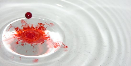 FDA Lessens Hurdles for Color Additive Changes in Drugs