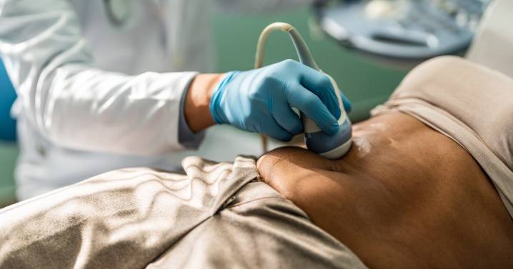 Appendix cancers on the rise in younger generations, study finds