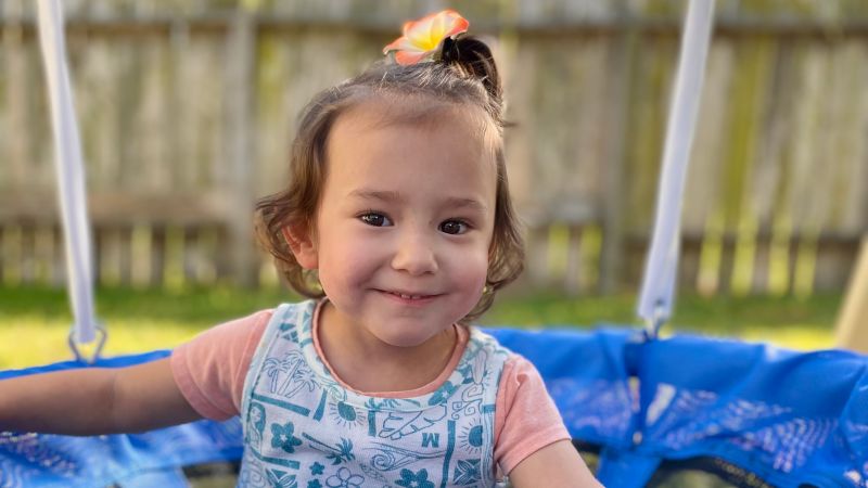 Texas girl thriving after fish skin helped heal her wound as a preemie: ‘I call her my little mermaid’