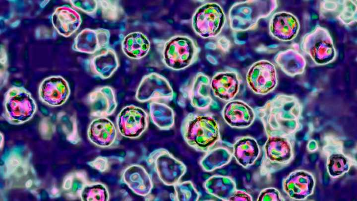 Wastewater is now helping track measles spread around the US