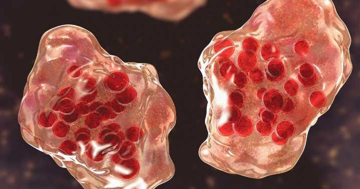 Public health officials confirm new measles case in LA County