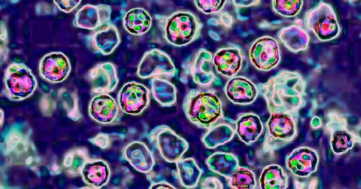 Wastewater is now helping track measles spread around the US