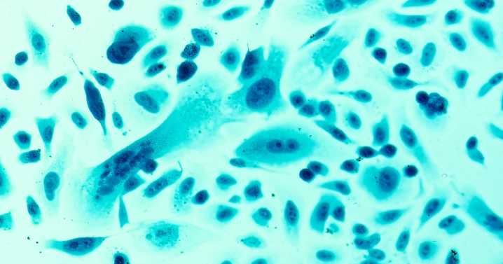 Niraparib regimen may slow cancer growth in prostate cancer subset