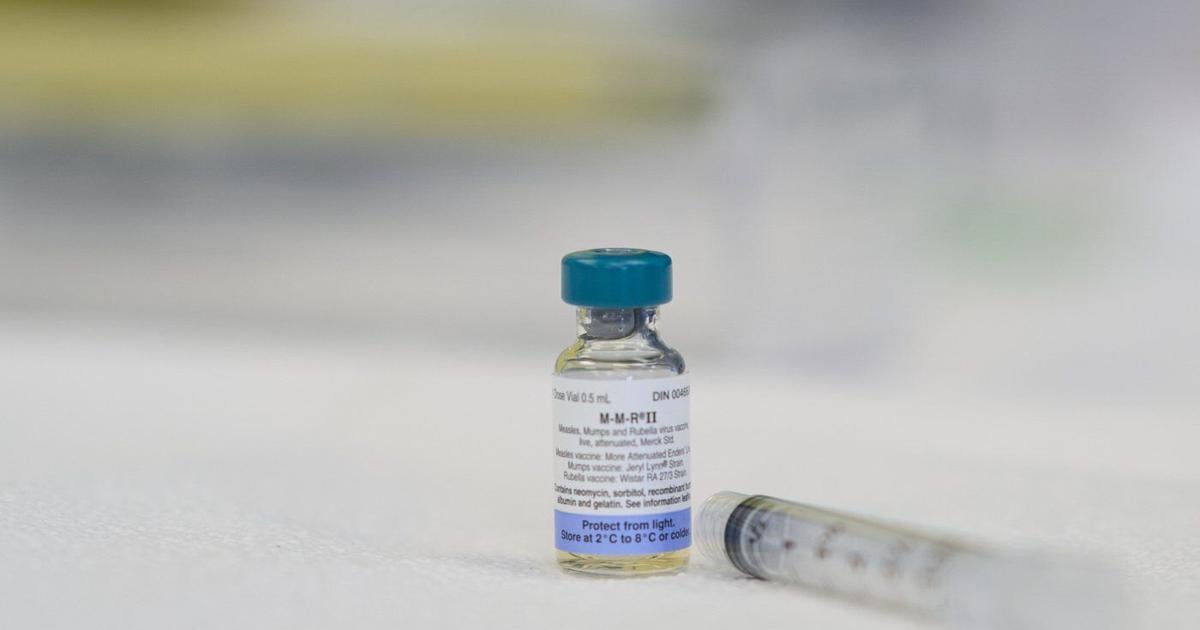 Don't know if you've been vaccinated against measles? Get a shot, doctors urge