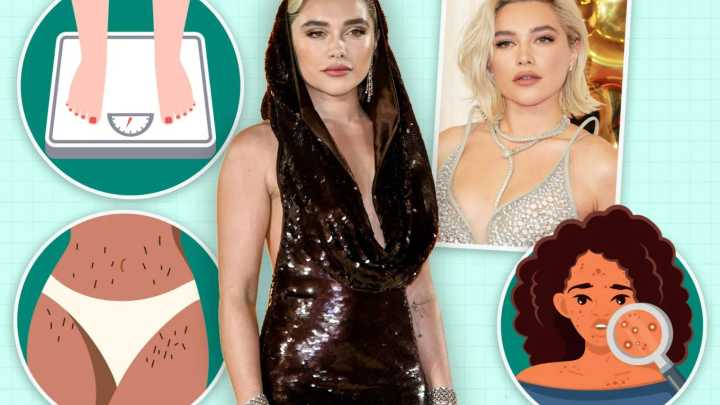 The 3 symptoms of actress Florence Pugh's condition she assumed were 'normal' until a DREAM prompted a check