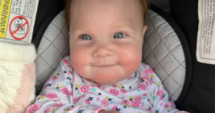 Children's Hospital Colorado pioneers first-of-its-kind cranial surgery for kids
