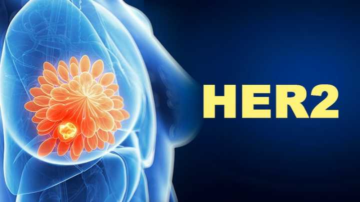 Which Tx Combo Is Best for HER2+ Breast Cancer?
