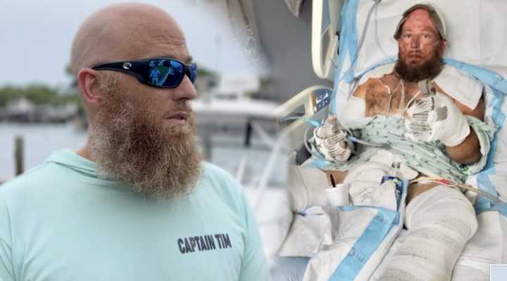 ‘It shouldn’t end in a nightmare’: Boat explosion survivor calls for new safety legislation