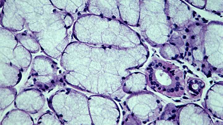 Mucus: the multipurpose disease preventor
