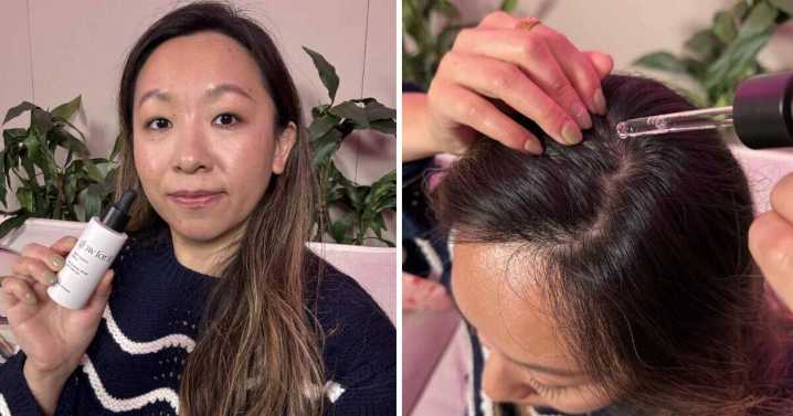 I used £35 hair growth serum for 30 days and it reshaped my hairline