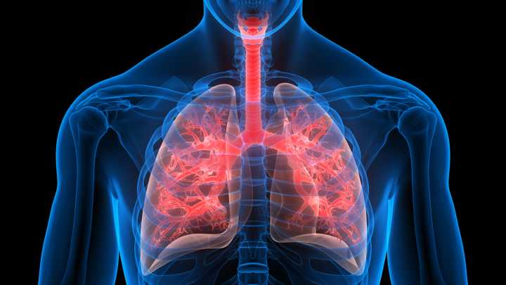 VEST Tool Accurately Identifies Severe Pulmonary Arterial Hypertension