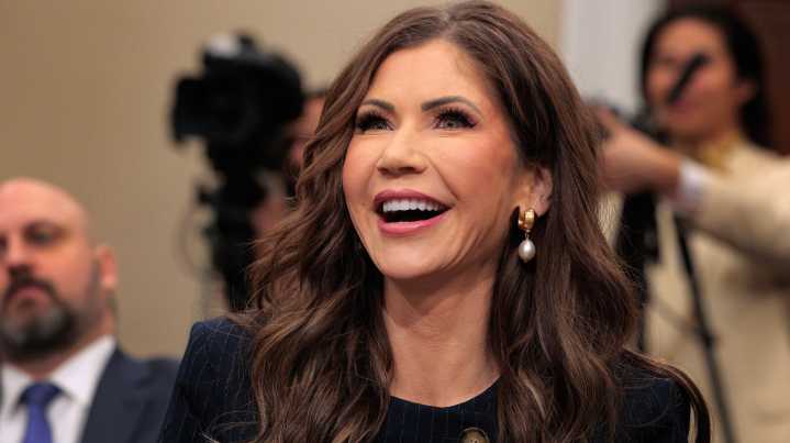 Why Kristi Noem's Teeth Have Landed Her In Hot Water