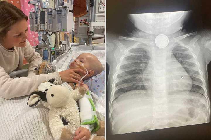 Toddler Goes to ER After Ingesting Button Battery, Recovery Was 'Torture' (Exclusive)