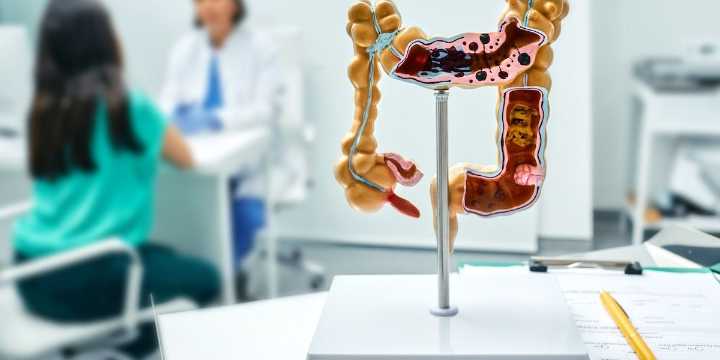 Colon Cancer Is Being Caught Earlier, Research Confirms