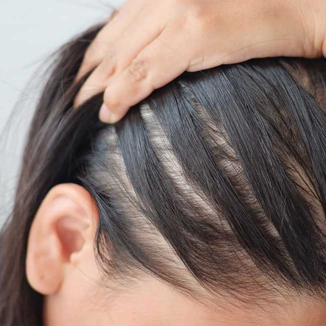 An Expert Breaks Down 5 Best Tips To Grow Your Hair Back Naturally