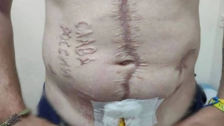 Ukrainian soldier released in prisoner swap left with ‘Glory to Russia’ burned on his body by Putin’s sick torturers