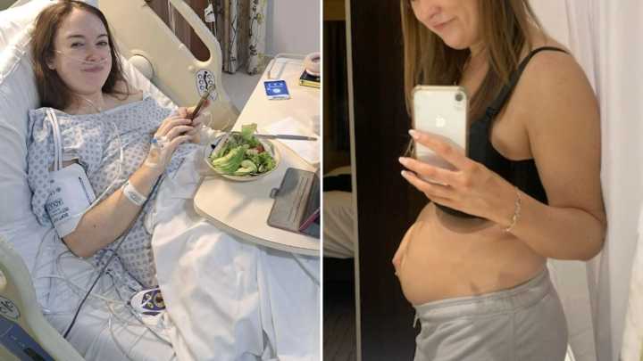 I was left looking five months' pregnant and couldn't have sex after doctors 'gaslit' me into thinking I had IBS