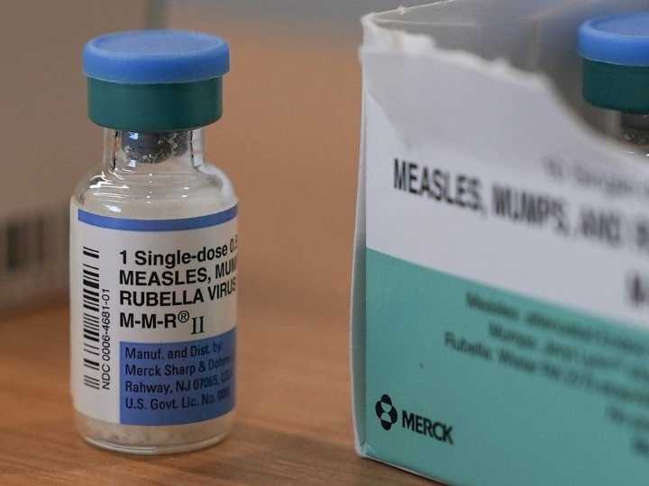 Alberta Health Services (AHS) warns of possible measles exposure